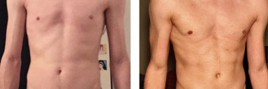 6 foot 2 Male Progress Pics of 33 lbs Muscle Gain 137 lbs to 170 lbs