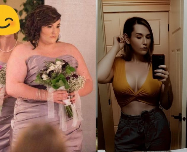 A before and after photo of a 6'6" female showing a weight reduction from 286 pounds to 180 pounds. A net loss of 106 pounds.