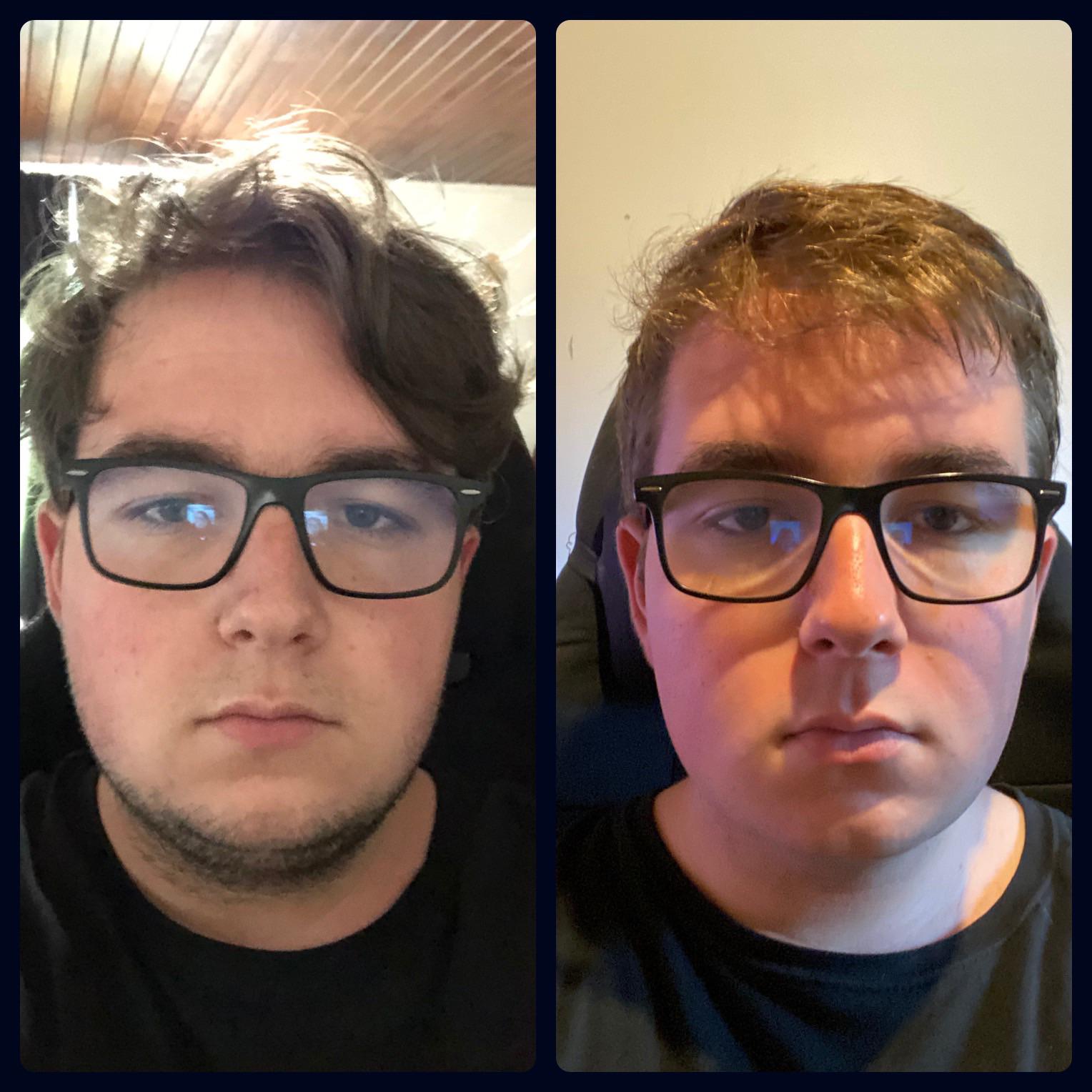 5 feet 7 Male 33 lbs Fat Loss Before and After 265 lbs to 232 lbs