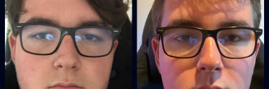 5 feet 7 Male Progress Pics of 33 lbs Fat Loss 265 lbs to 232 lbs