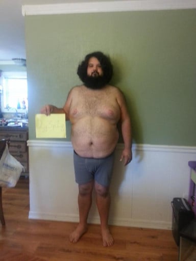 3 Photos of a 6 foot 3 341 lbs Male Weight Snapshot