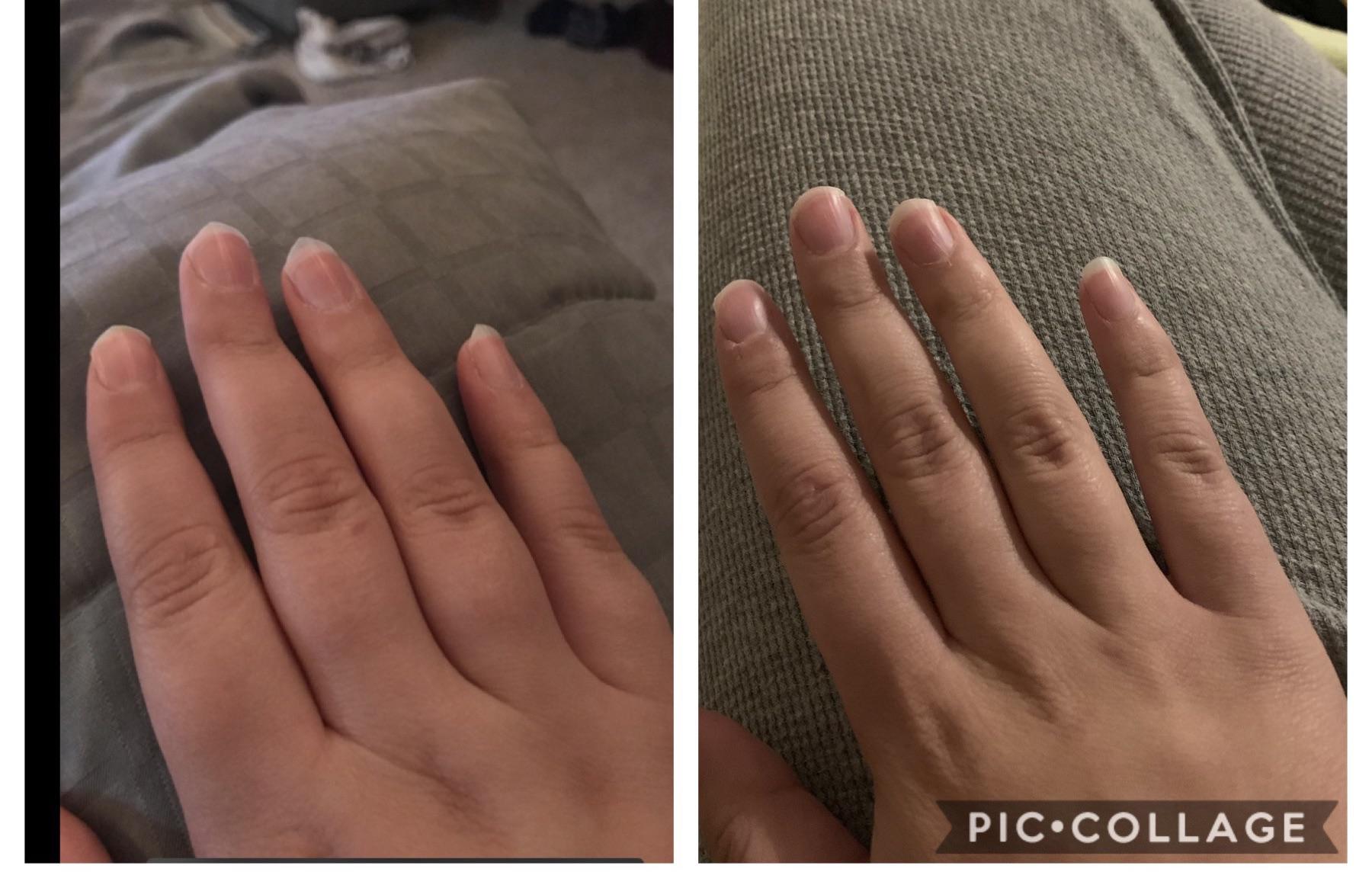 50 lbs Fat Loss Before and After 5 foot 8 Female 220 lbs to 170 lbs