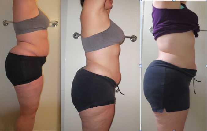 13 lbs Weight Loss 5'11 Female 282 lbs to 269 lbs