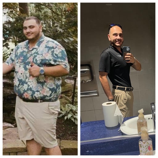 Before and After 157 lbs Weight Loss 6 foot Male 333 lbs to 176 lbs