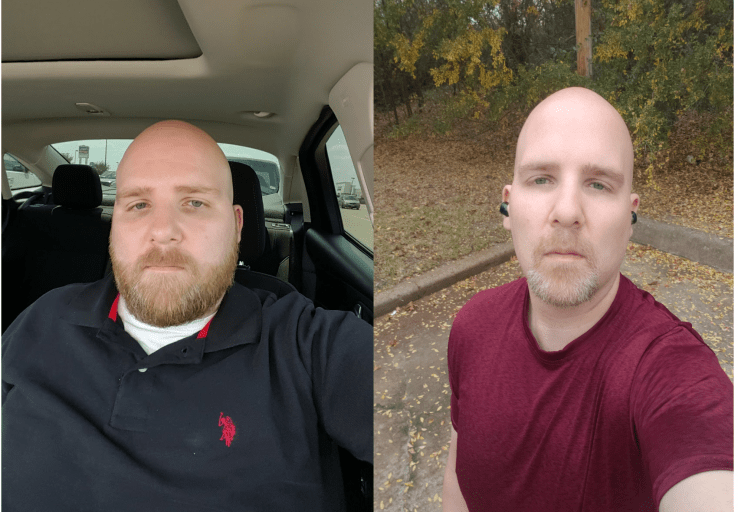 A picture of a 5'7" male showing a weight loss from 240 pounds to 170 pounds. A respectable loss of 70 pounds.