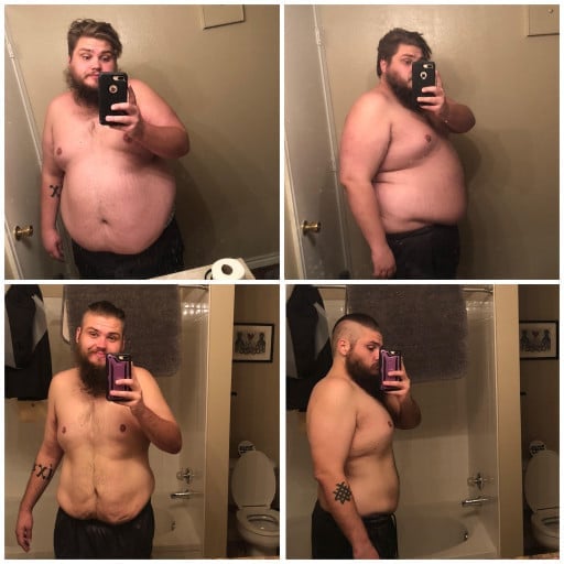 A before and after photo of a 6'0" male showing a weight reduction from 375 pounds to 250 pounds. A net loss of 125 pounds.