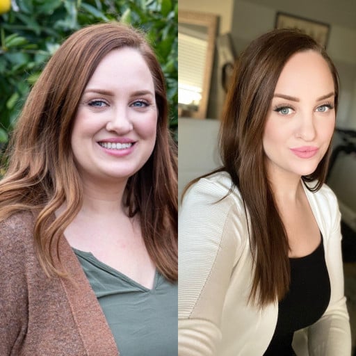 F/36/5'6 [184 > 149 = 35 Pounds] Last Christmas to Today: I've Made Lots of Changes During Quarantine and Was Gifted with a Whole New Face
