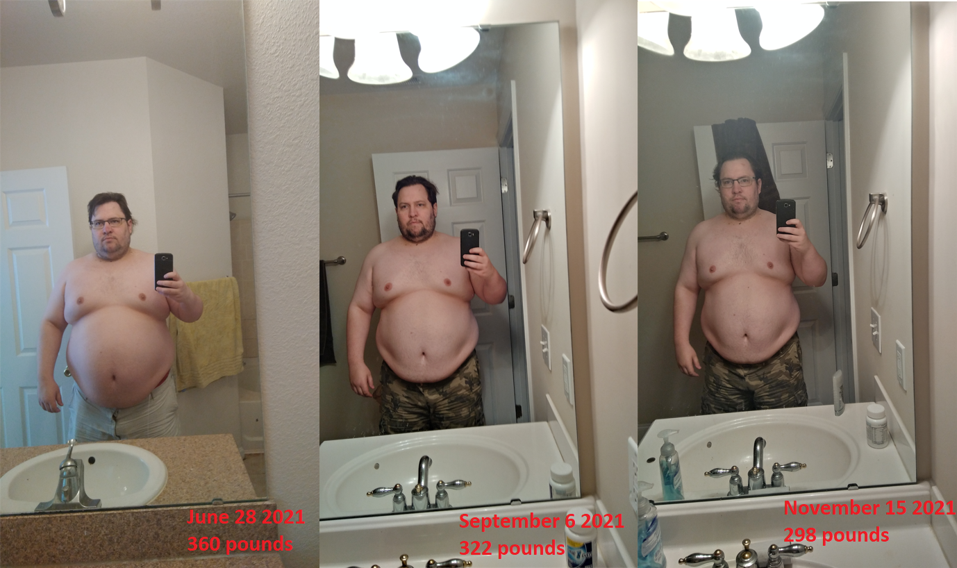 5 foot 10 Male Before and After 60 lbs Weight Loss 360 lbs to 300 lbs