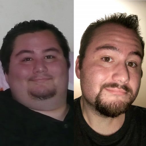 A photo of a 5'11" man showing a weight loss from 472 pounds to 291 pounds. A respectable loss of 181 pounds.