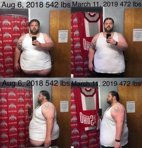 6 foot 1 Male 70 lbs Weight Loss Before and After 542 lbs to 472 lbs