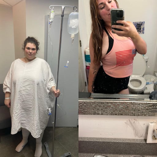 A progress pic of a 5'6" woman showing a fat loss from 340 pounds to 175 pounds. A net loss of 165 pounds.