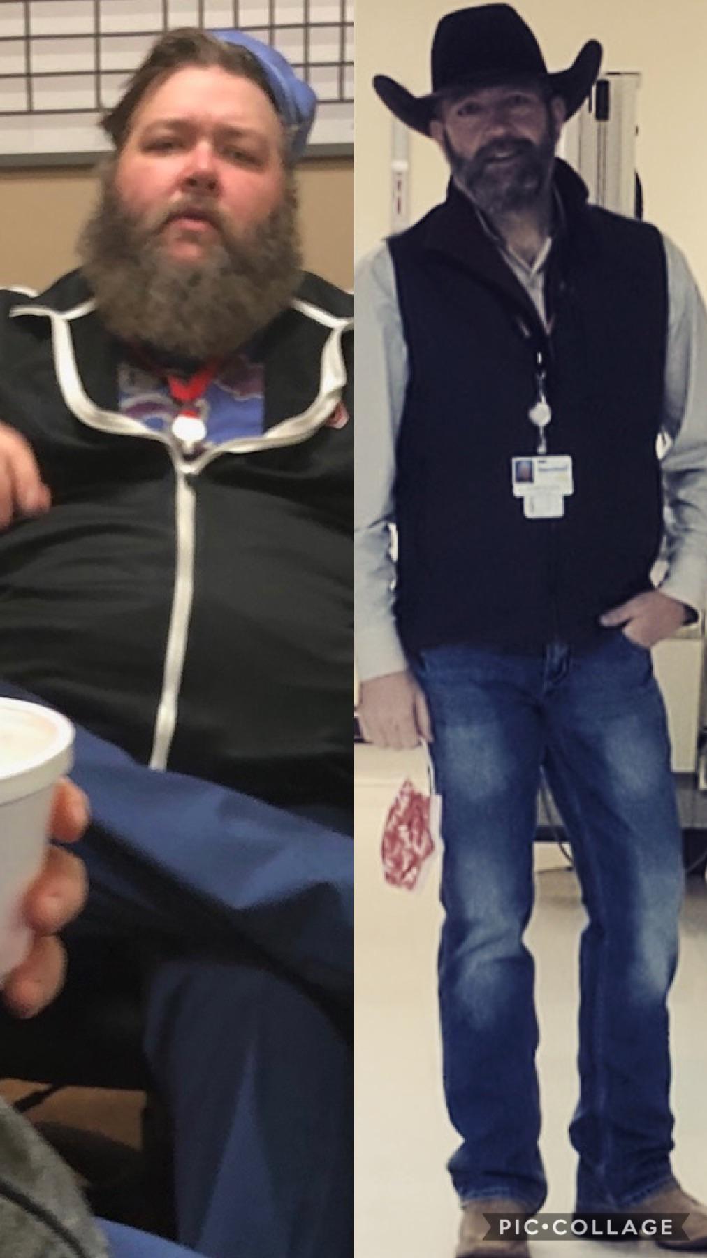 225 lbs Weight Loss 6'1 Male 428 lbs to 203 lbs