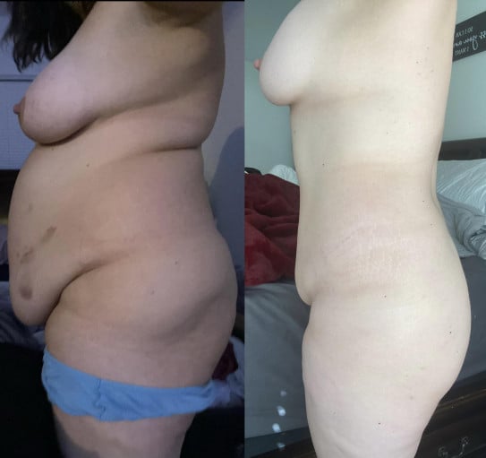 5 foot 3 Female Progress Pics of 65 lbs Fat Loss 235 lbs to 170 lbs