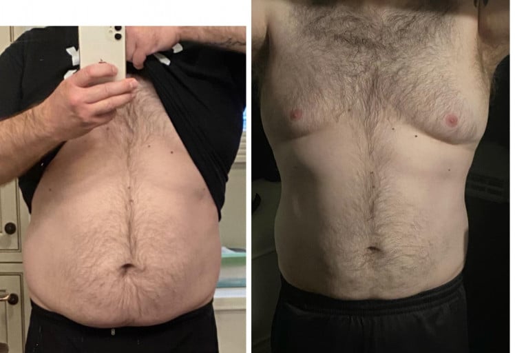 5 foot 9 Male Progress Pics of 40 lbs Fat Loss 249 lbs to 209 lbs