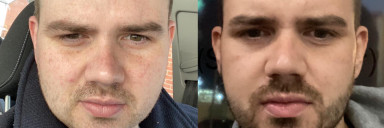 5 feet 10 Male Progress Pics of 61 lbs Fat Loss 276 lbs to 215 lbs