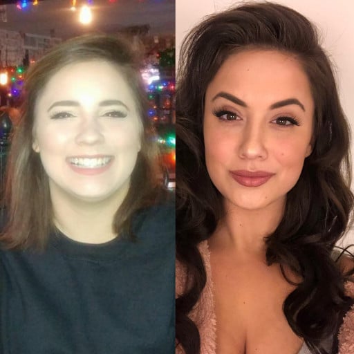 26 Year Old Woman Loses 43 Pounds and Reveals Her Jawline