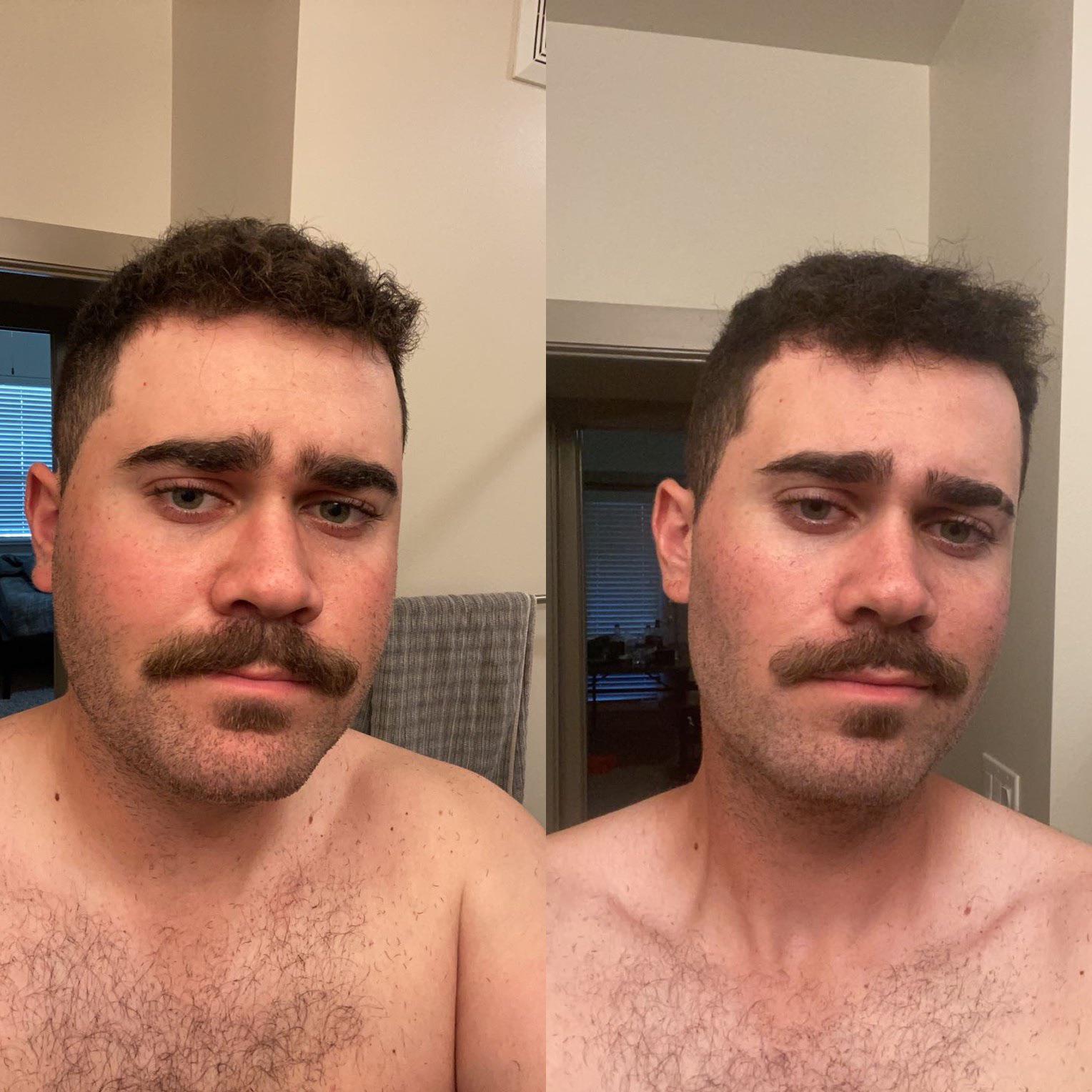 5 feet 11 Male 41 lbs Weight Loss Before and After 206 lbs to 165 lbs