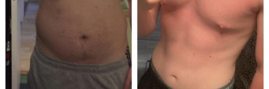 6'1 Male 70 lbs Fat Loss Before and After 240 lbs to 170 lbs