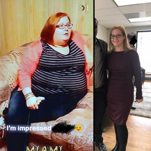 A before and after photo of a 5'3" female showing a weight reduction from 322 pounds to 140 pounds. A net loss of 182 pounds.
