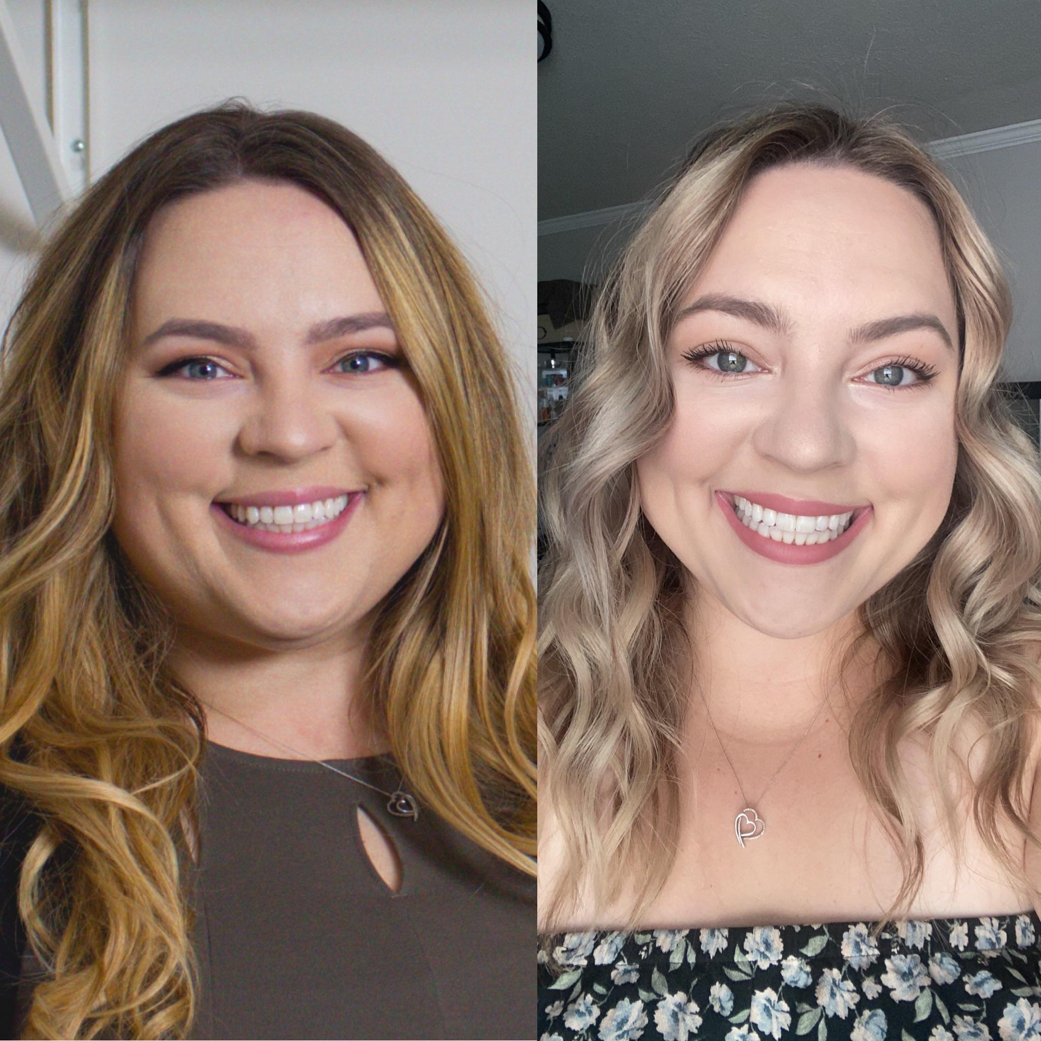 5 feet 2 Female 20 lbs Fat Loss Before and After 230 lbs to 210 lbs