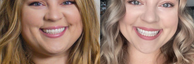 5 feet 2 Female 20 lbs Fat Loss Before and After 230 lbs to 210 lbs