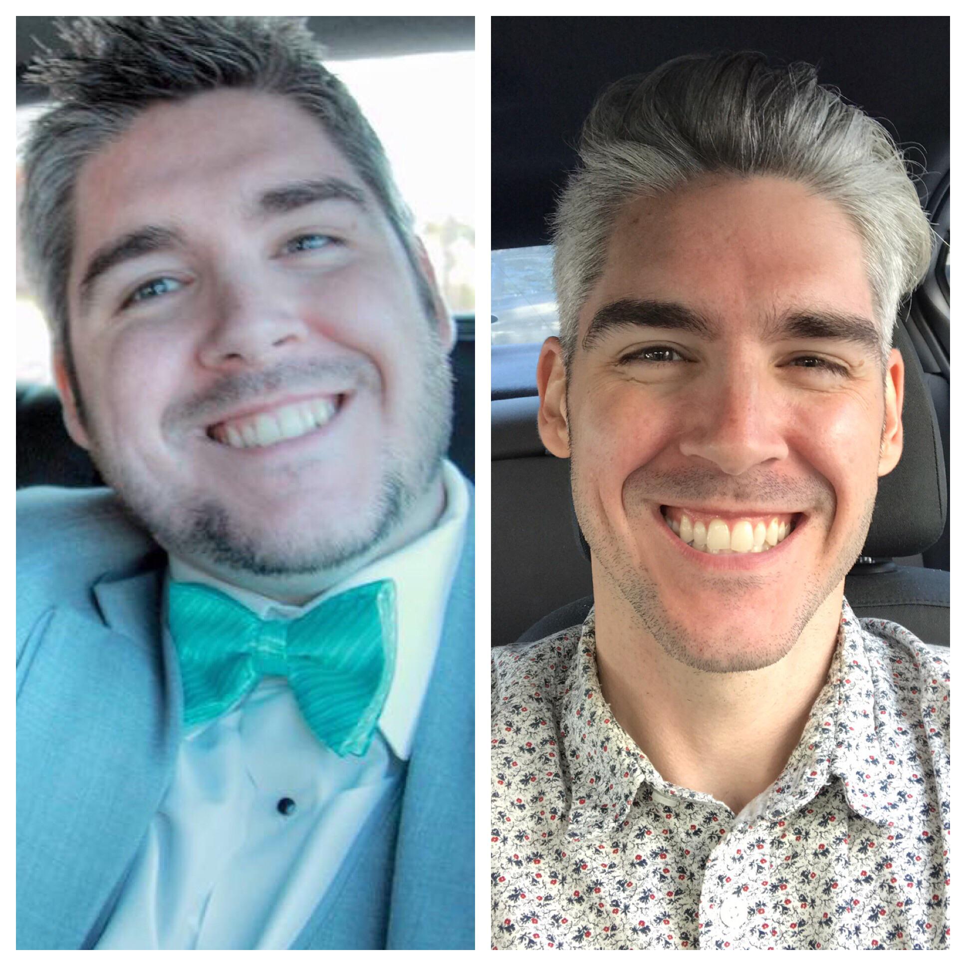 Progress Pics of 112 lbs Fat Loss 5 foot 10 Male 275 lbs to 163 lbs