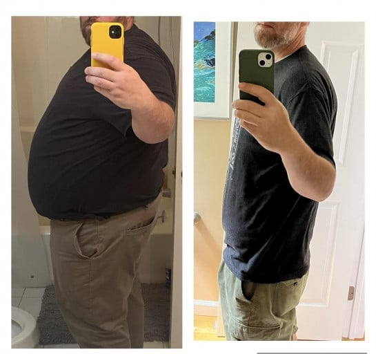 A before and after photo of a 6'2" male showing a weight reduction from 428 pounds to 228 pounds. A net loss of 200 pounds.