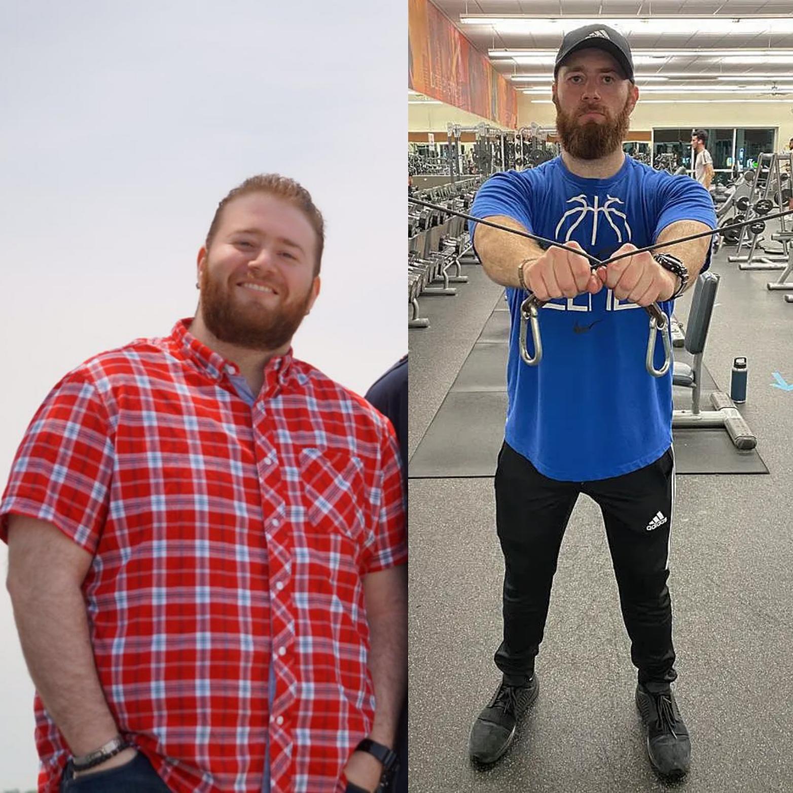 6 foot Male 100 lbs Weight Loss 310 lbs to 210 lbs