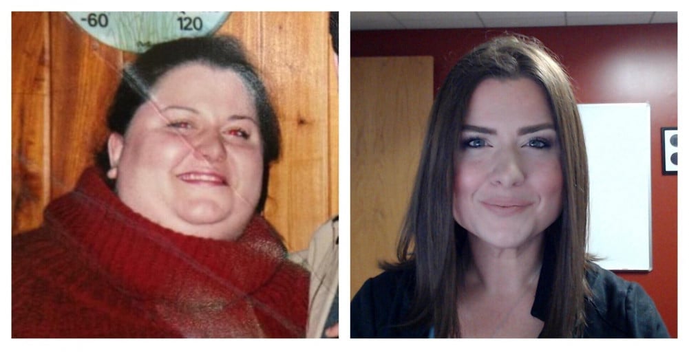 220 lbs Fat Loss Before and After 5 foot 7 Female 408 lbs to 188 lbs
