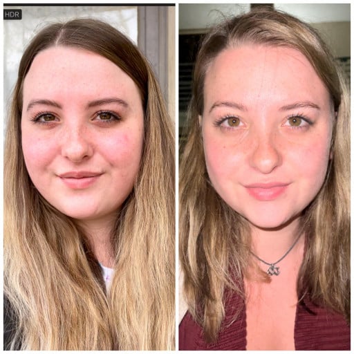 F/22/5'9": Weight Loss Journey with Visible Face Gains a Story of Confidence Regained