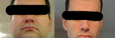 6 feet 4 Male 192 lbs Weight Loss 298 lbs to 106 lbs