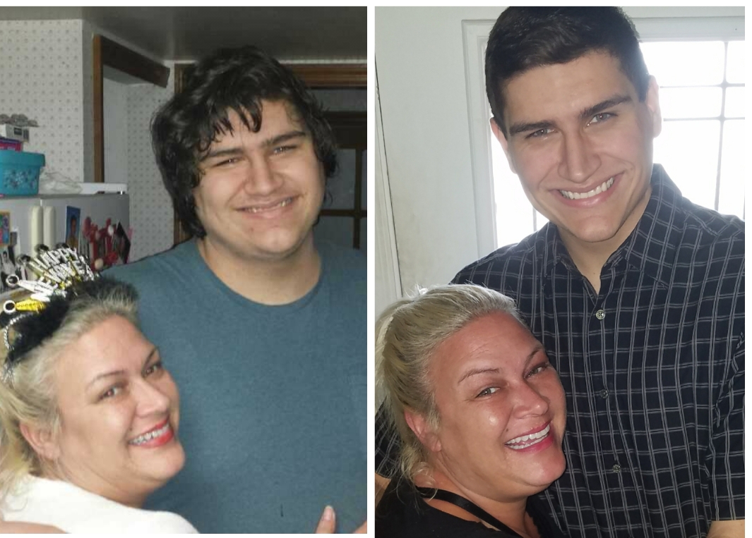 6 foot 3 Male 120 lbs Weight Loss 330 lbs to 210 lbs