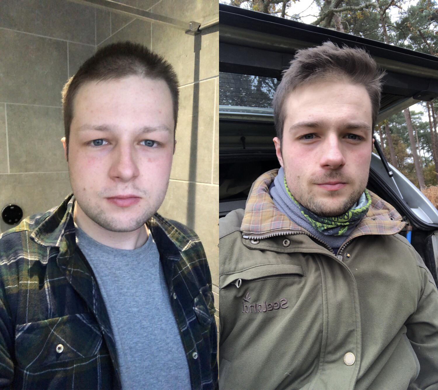 5'10 Male 28 lbs Weight Loss 216 lbs to 188 lbs