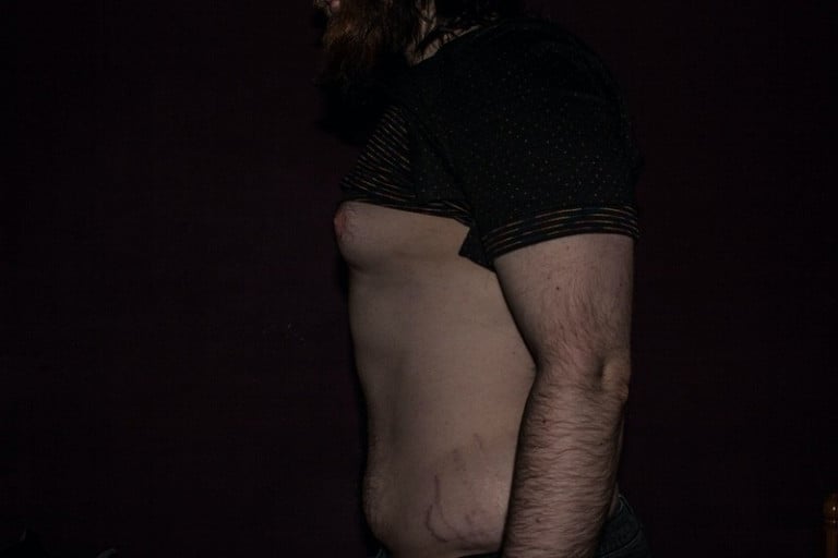 A picture of a 5'11" male showing a fat loss from 265 pounds to 217 pounds. A total loss of 48 pounds.