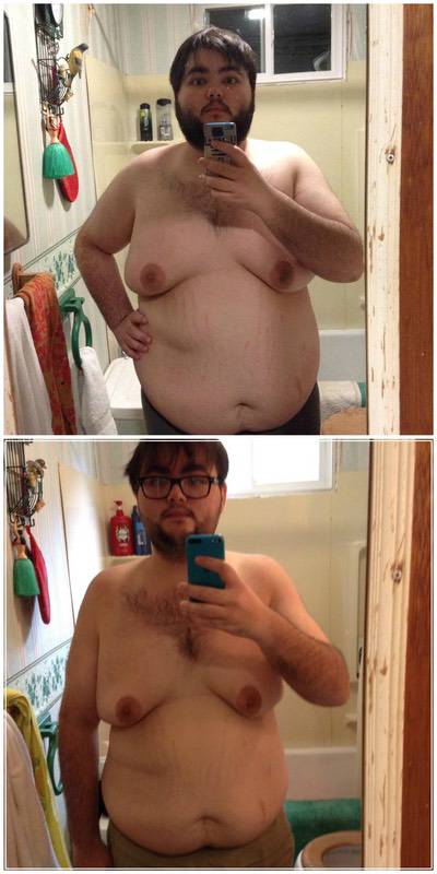 5'8 Male Before and After 122 lbs Fat Loss 311 lbs to 189 lbs