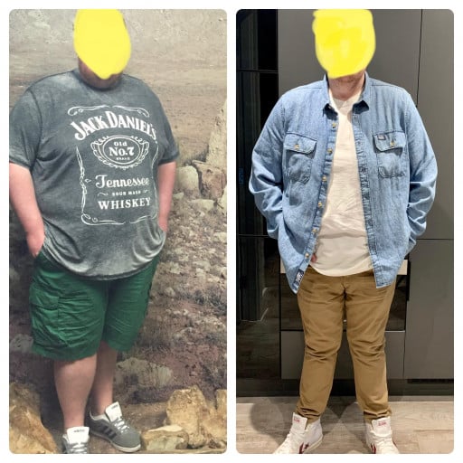 A before and after photo of a 6'0" male showing a weight reduction from 386 pounds to 225 pounds. A net loss of 161 pounds.