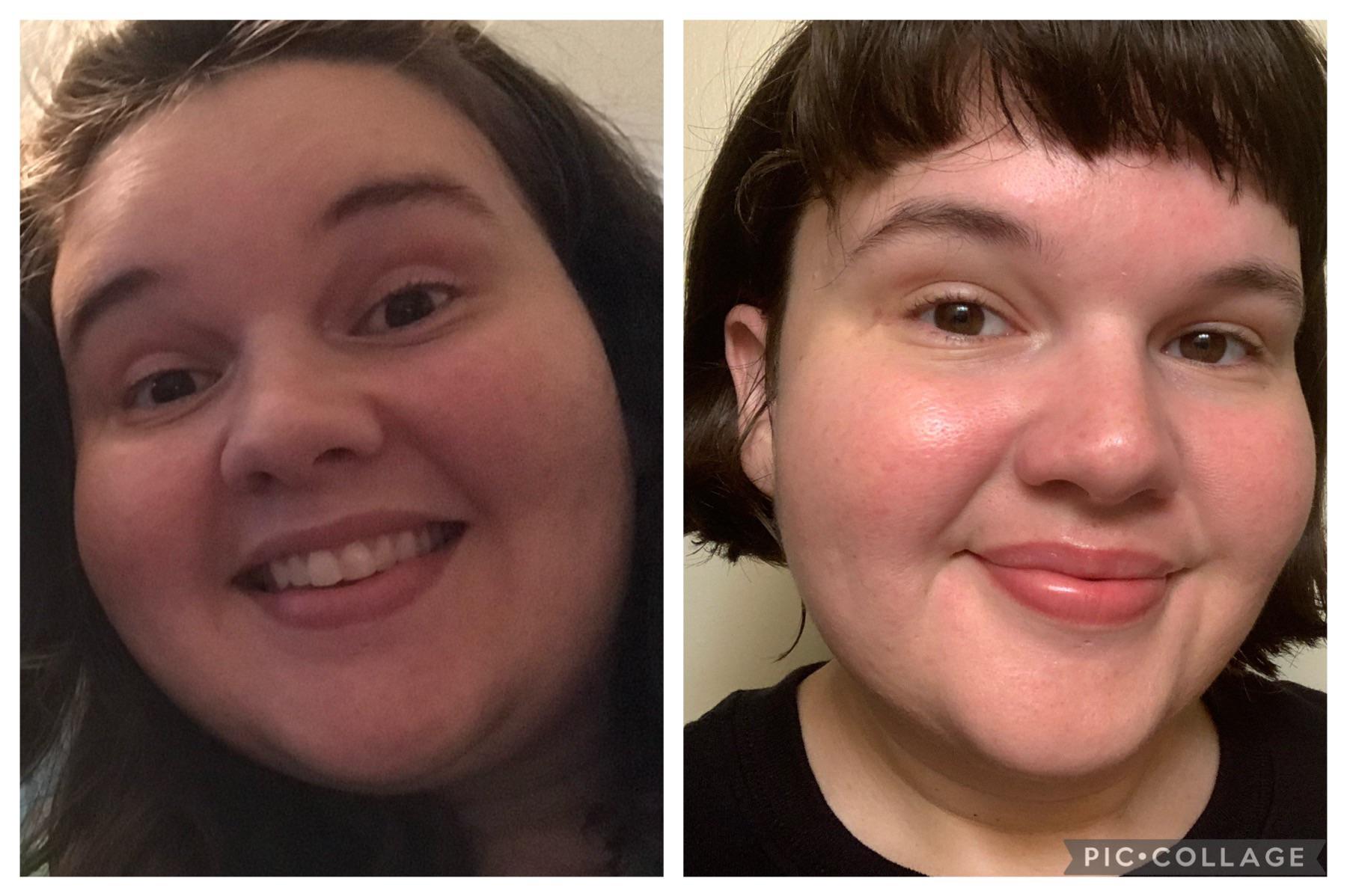 Before and After 46 lbs Weight Loss 5 foot 4 Female 322 lbs to 276 lbs