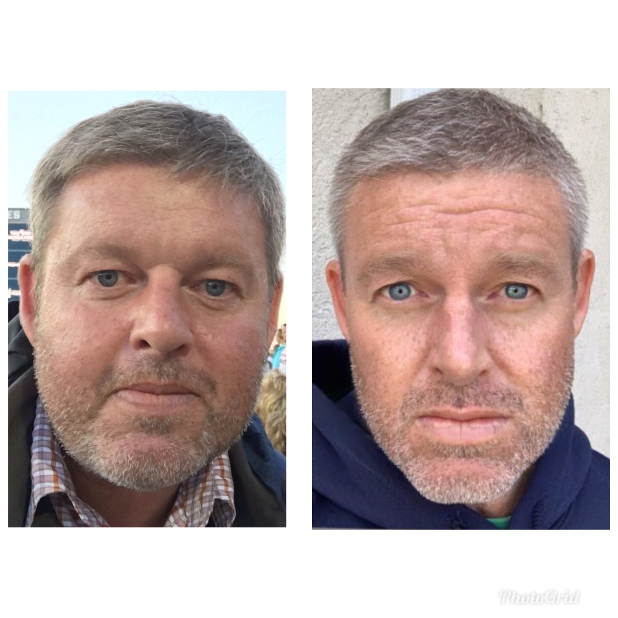 Before and After 85 lbs Fat Loss 5 feet 11 Male 268 lbs to 183 lbs