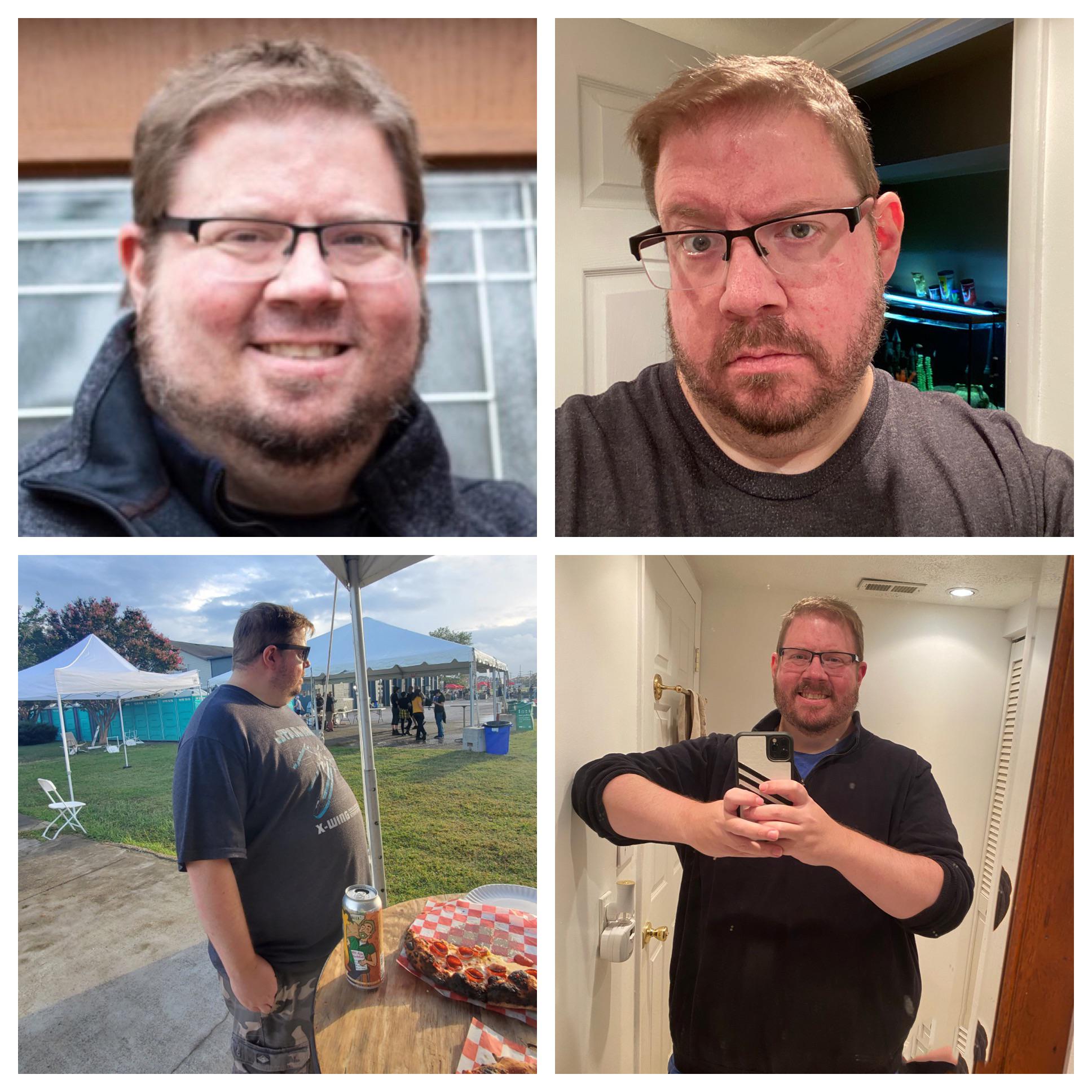 75 lbs Weight Loss Before and After 6 feet 1 Male 400 lbs to 325 lbs