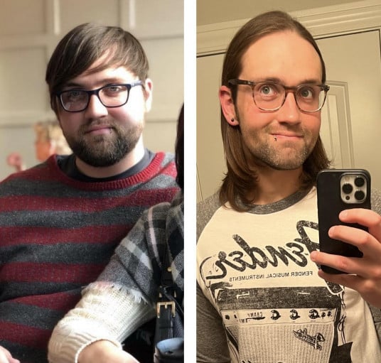 M/29/6'3" [266 lbs >190lbs= 76lbs] 2 years to take the weight off. 2 years of maintenance. Face gains.