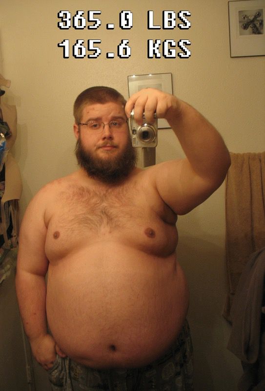 5'9 Male 94 lbs Fat Loss Before and After 365 lbs to 271 lbs