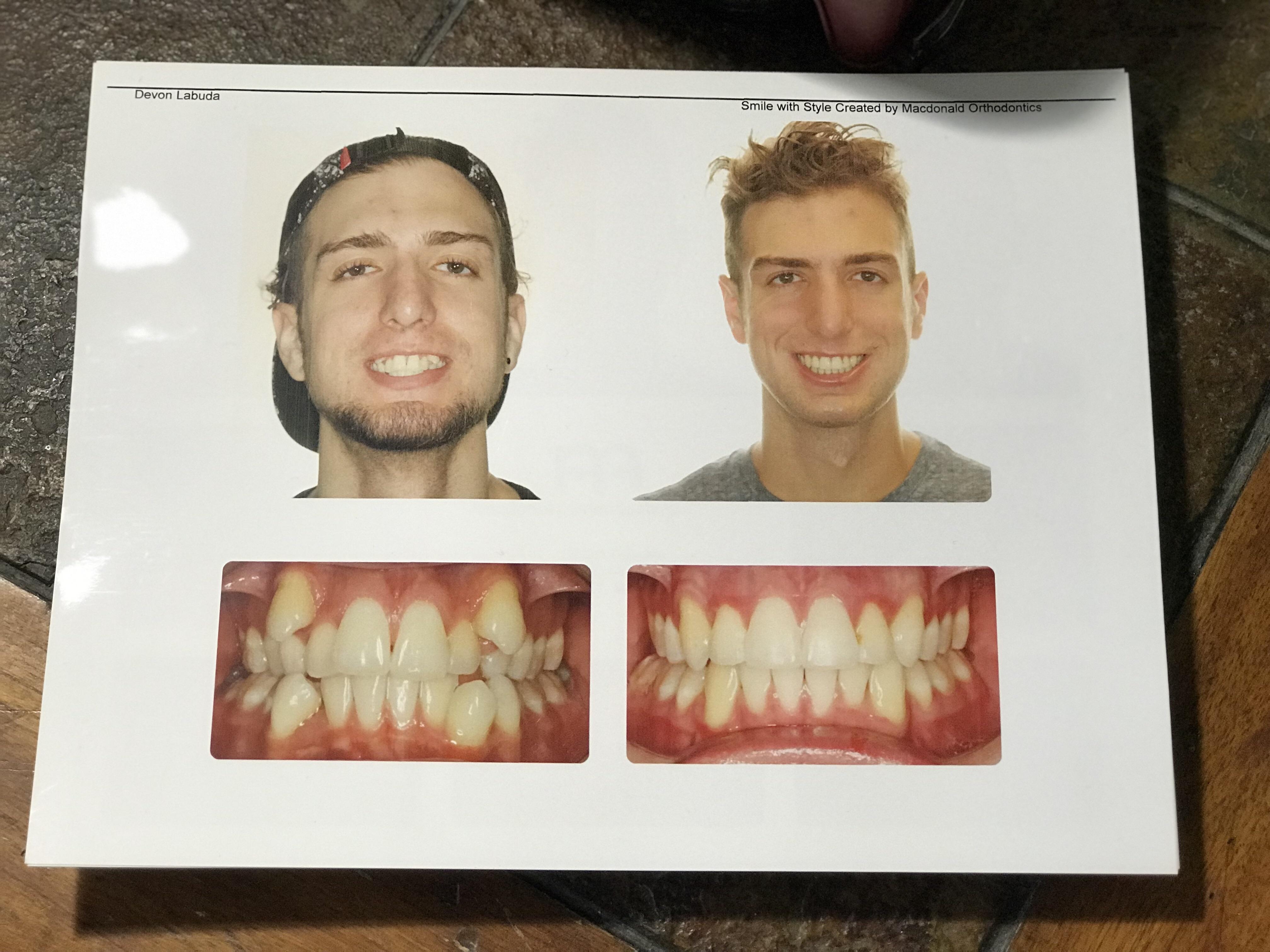 1 Photo of a 6 foot 2 175 lbs Male Weight Snapshot