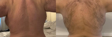 Progress Pics of 40 lbs Weight Loss 5 feet 11 Male 310 lbs to 270 lbs