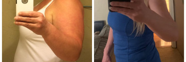 Progress Pics of 154 lbs Fat Loss 5 foot 5 Female 287 lbs to 133 lbs