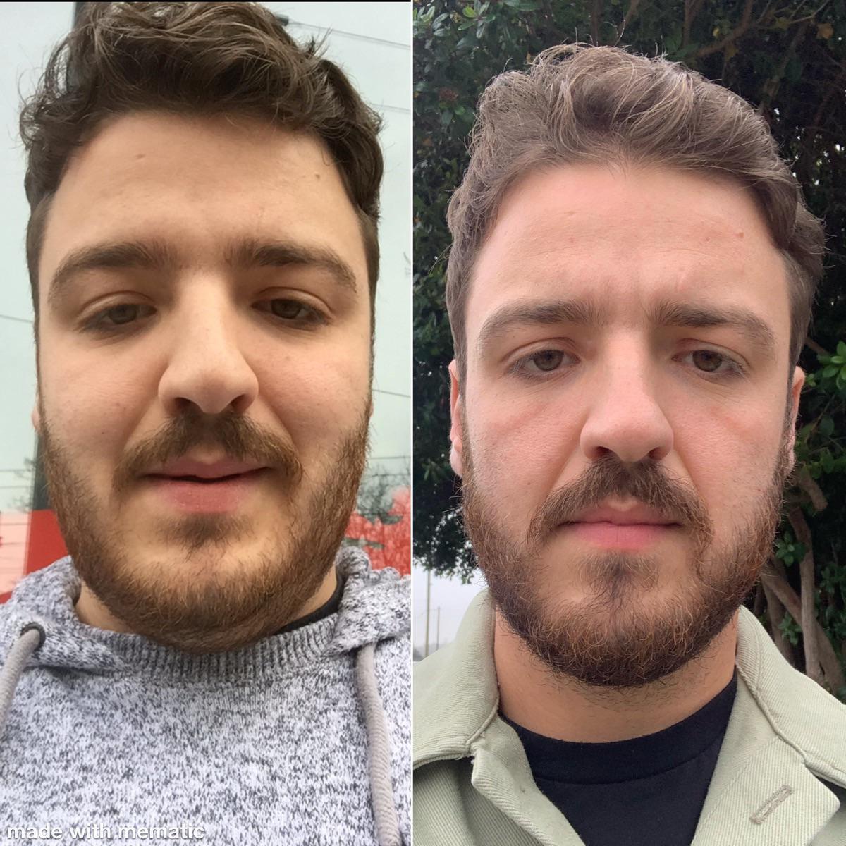 Before and After 40 lbs Weight Loss 5'10 Male 230 lbs to 190 lbs