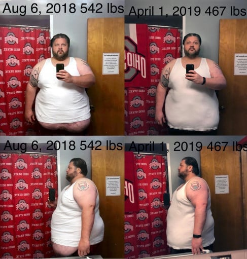 Progress Pics of 75 lbs Fat Loss 6'1 Male 542 lbs to 467 lbs