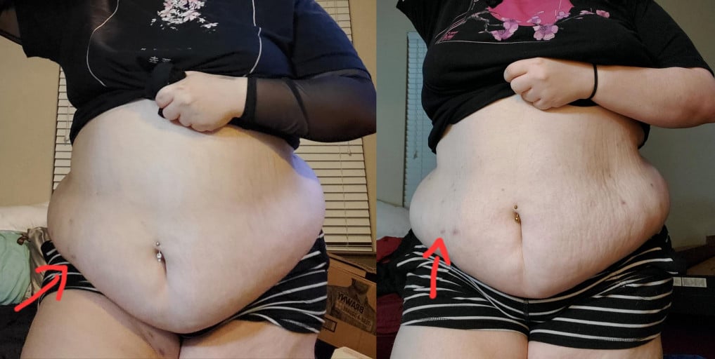 A progress pic of a 5'2" woman showing a fat loss from 295 pounds to 259 pounds. A total loss of 36 pounds.