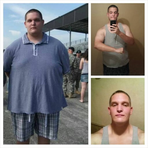 A before and after photo of a 6'3" male showing a weight reduction from 400 pounds to 285 pounds. A net loss of 115 pounds.