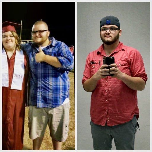 A picture of a 6'0" male showing a weight loss from 335 pounds to 242 pounds. A respectable loss of 93 pounds.