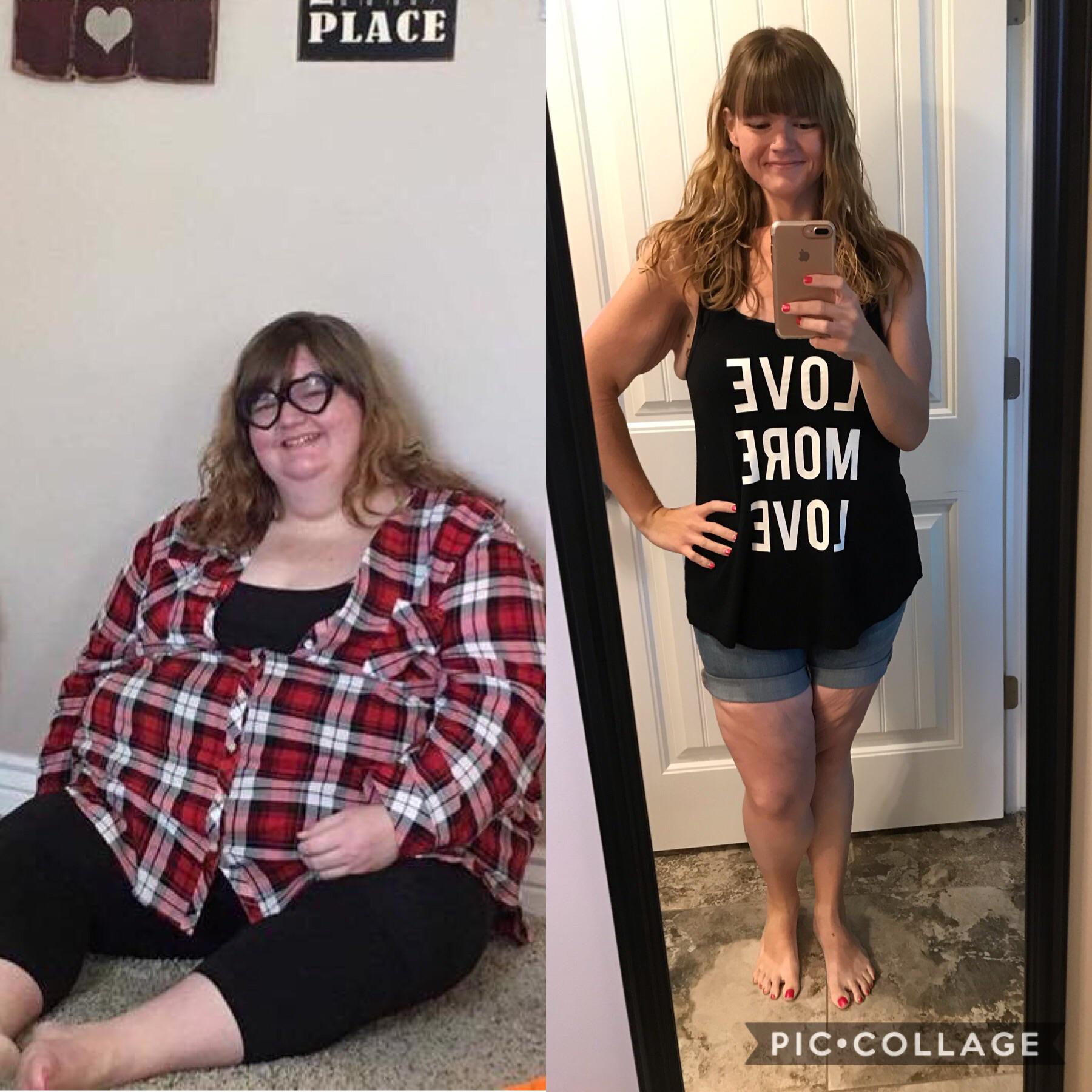 Before and After 250 lbs Weight Loss 5 feet 6 Female 425 lbs to 175 lbs.
